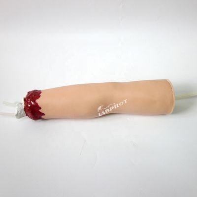 트라우마 간호 치료 모델 팔 절단 및 위 다리 상처 치료에 대한 혈전