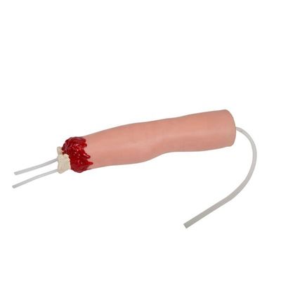 트라우마 간호 치료 모델 팔 절단 및 위 다리 상처 치료에 대한 혈전