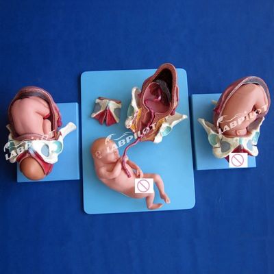 의학적 해부학 시범 모델 출산 골반 및 정년 태아 모델