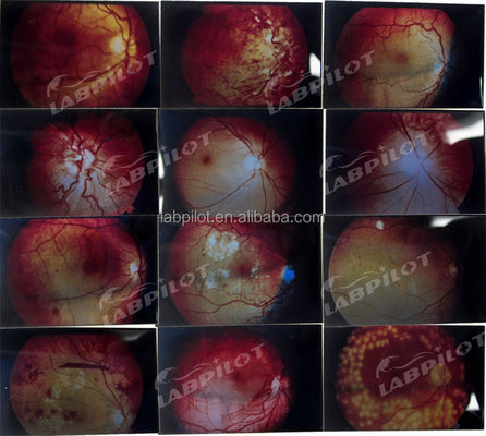PVC 눈 검사 인간 생명 크기 funduscopic 검사 교육 모델