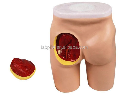 골목 근육 및 해부학 교육에 대한 포괄적인 IM 주사 교육 모델