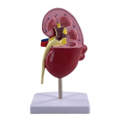 의과대학 및 비뇨기병원용 PVC 병리신부 모델 시범