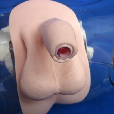 환자를 위한 마니킨 치료 시범 투명한 요도관 카테테테리즘 훈련