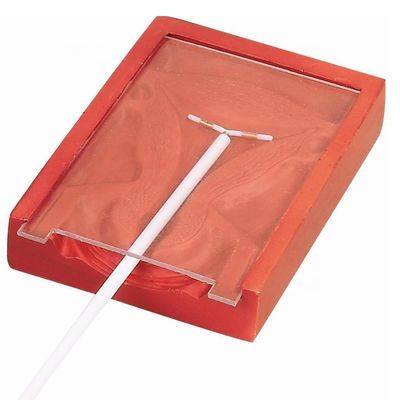 산부인과 및 산부인과 기술 교육 IUD 삽입 교육자 환자 돌봄