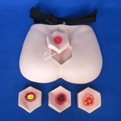 환자 돌봄 시범 압력 상처 간호 모델 단계 침상 상처 교육 모델